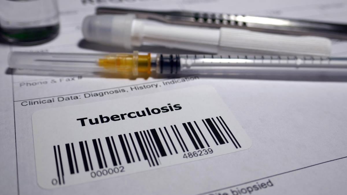 HEALTH Puducherry Becomes First to Include TB Patients Under Family Adoption Programme
