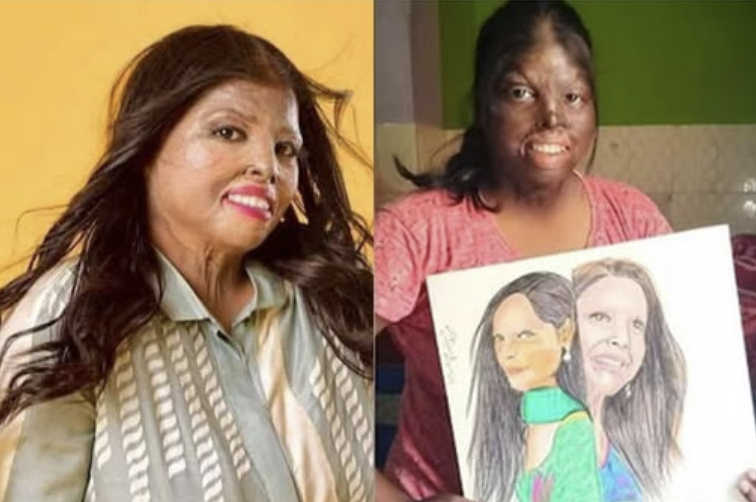 Mannu: The Burn Survivor Who Taught the World What True Beauty Means